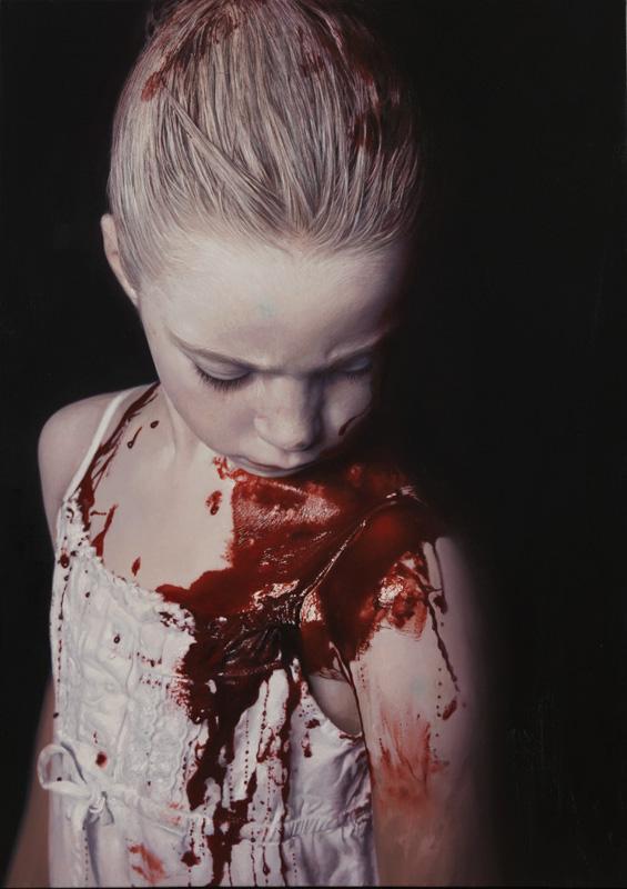 Gottfried Helnwein Untitled (The Disasters of War 27), 2011 aus der Serie "Disasters of War" Christian Baha, Zürich © Gottfried Helnwein